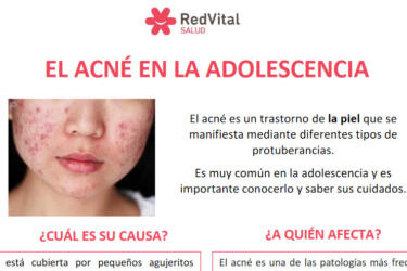 RedVital Salud: Acné en la pubertad